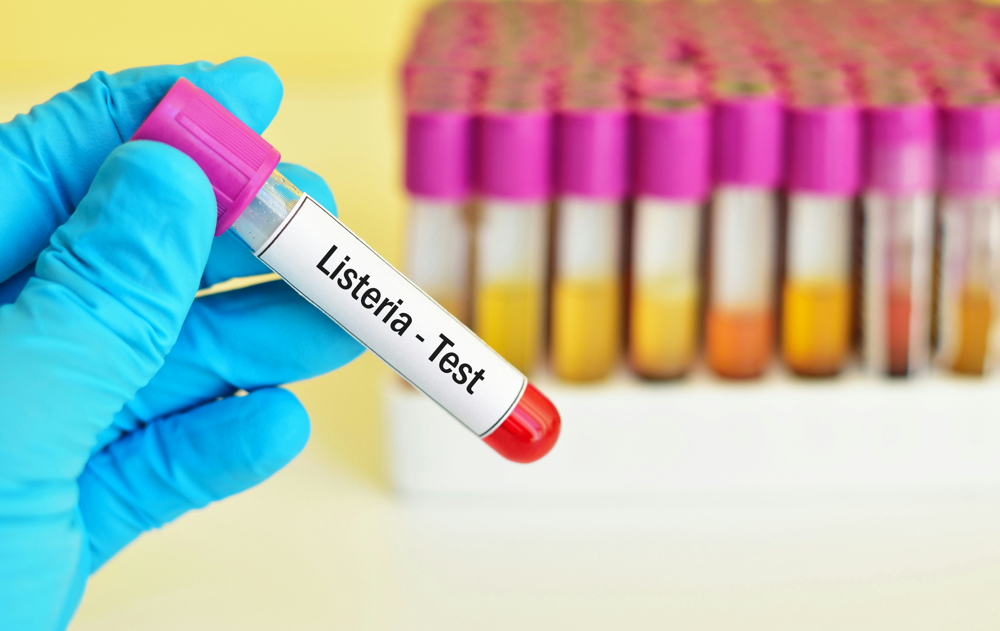 Listeria-besmetting, wie is aansprakelijk?